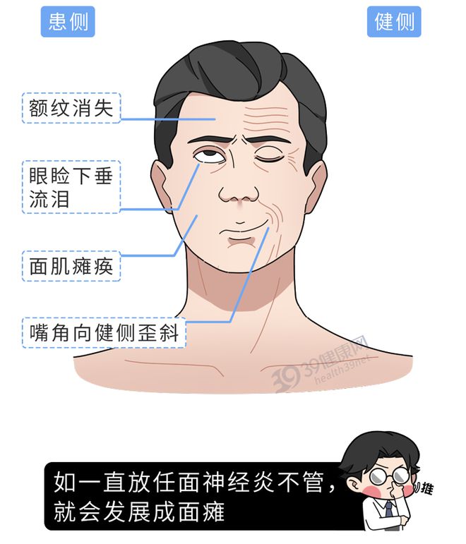 阵发性室上性心动过速/治疗_阵发性房动心动过速_阵发性房性心动