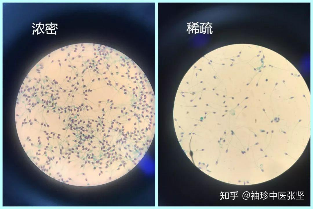 手机精子游戏下载_手机精子游戏下载_手机精子游戏下载